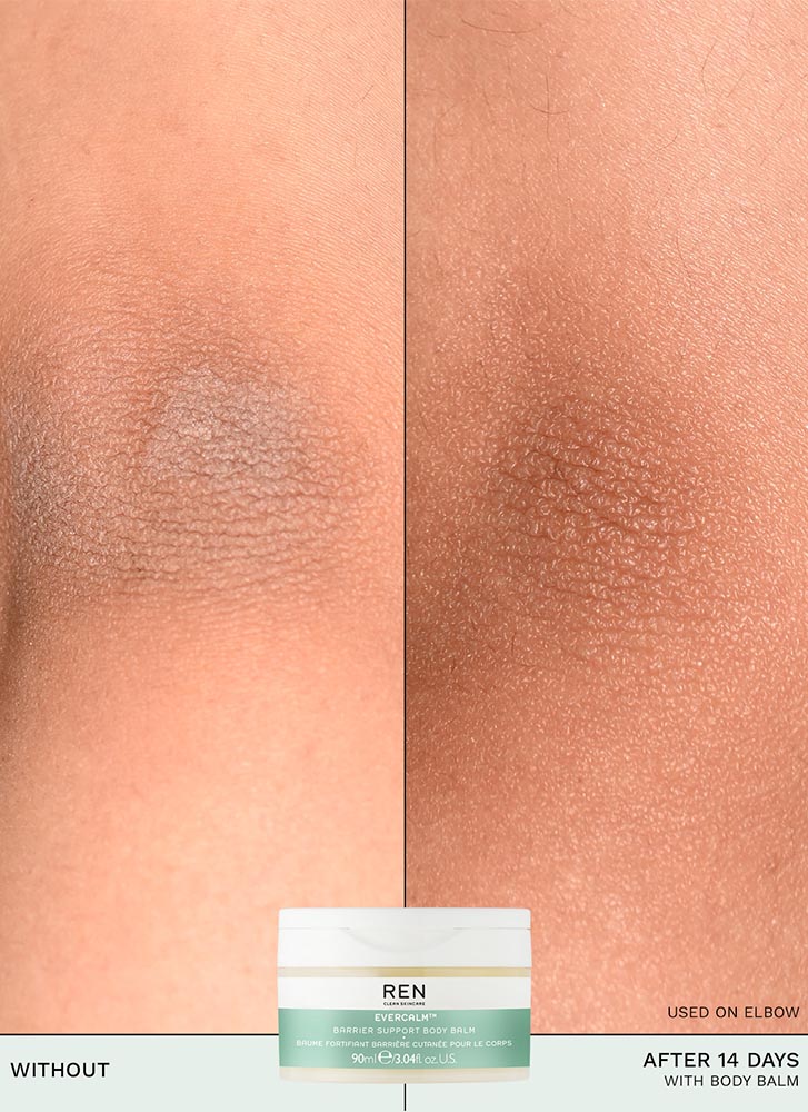 REN Clean Skincare Evercalm Barrier Support Body Balm